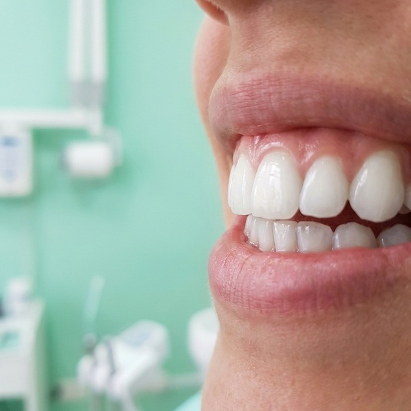 Instagram post of Dental Prado 🦷